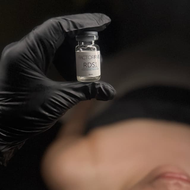 Factor Five RDS Peel Package at True Skin By Norie in Las Vegas, NV